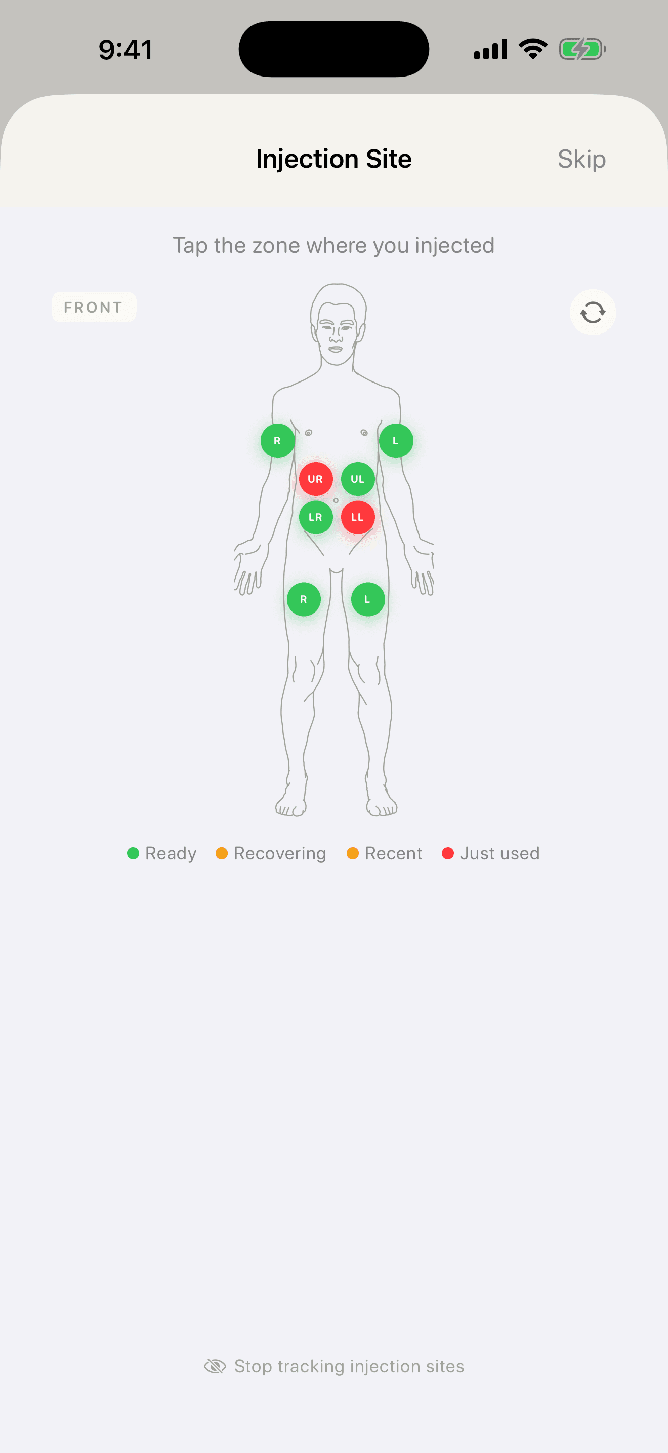Injection site rotation map